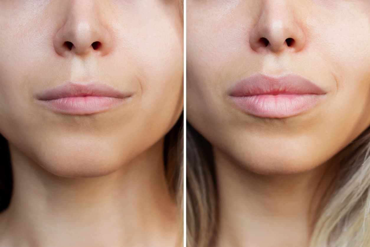 Plastic Surgery Before and After Galleries: The Hidden Conversion Driver Most Surgeons Underuse
